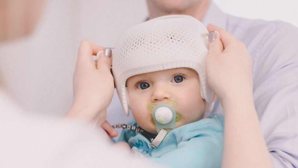 Does My Baby Need a Helmet? KranialFrom Bebek Kask Tedavi Merkezi