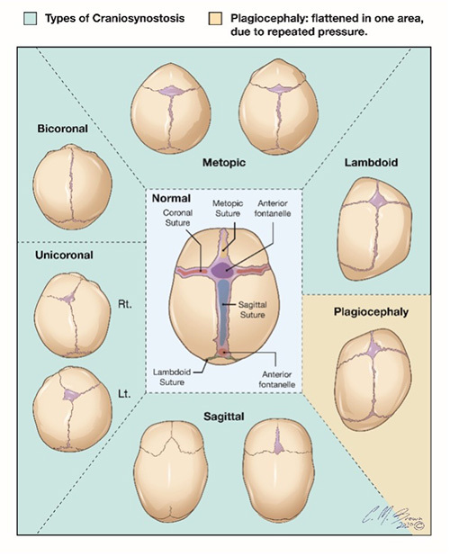 head shapes.jpg